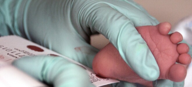 Неонатальный скрининг новорожденным