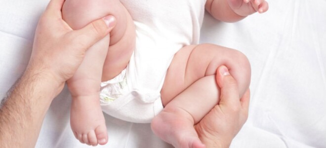 Несимметричные складки на ножках новорожденного